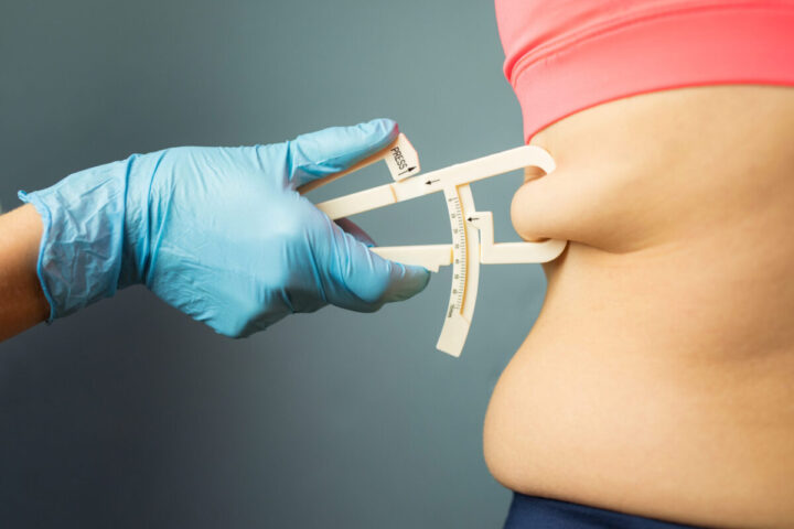 utrata masy ciała przed abdominoplastyką