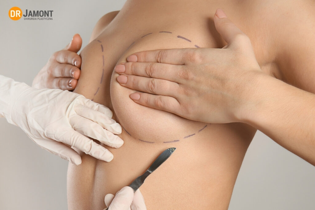 przygotowanie do operacji powiększenia piersi