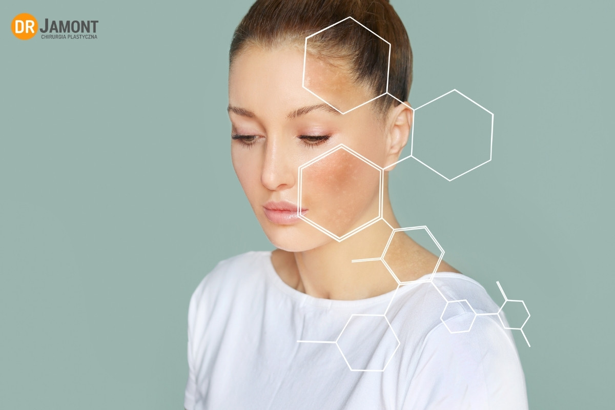 zaburzenia pigmentacji