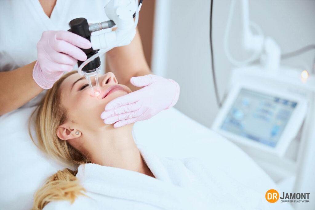 laser co2 na rozszerzone pory