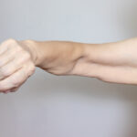 wiotka skóra ramion