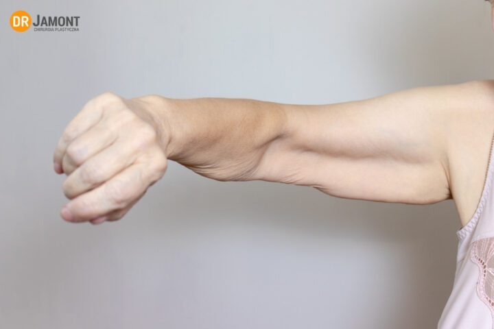 wiotka skóra ramion