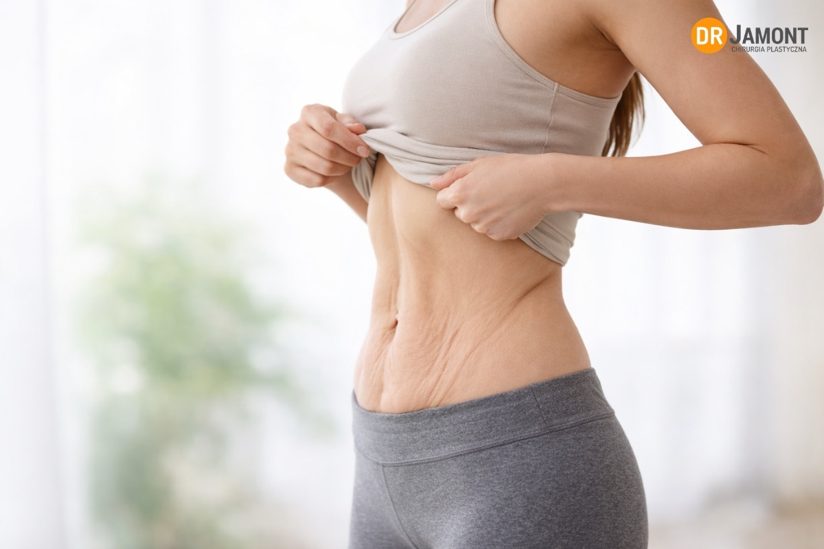 wiotka skóra po odchudzaniu