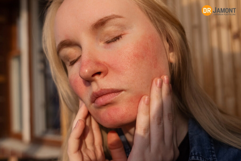 podrażniona skóra twarzy